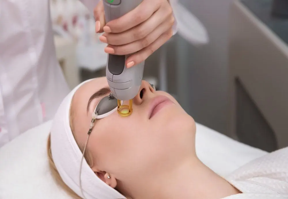 Fractional CO2 Laser treatment at Kira Exotica, a beauty salon in Indore